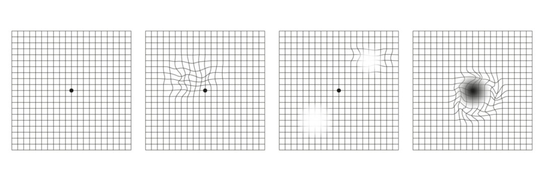 Set of amsler grid, medical test