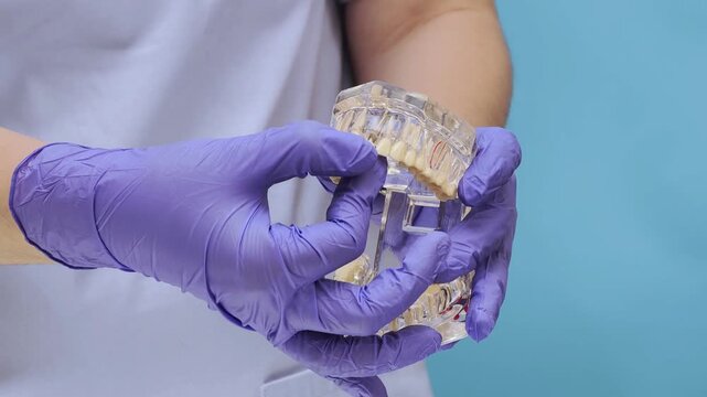 Dentist showing transparent jaw model with missing tooth and implant placement