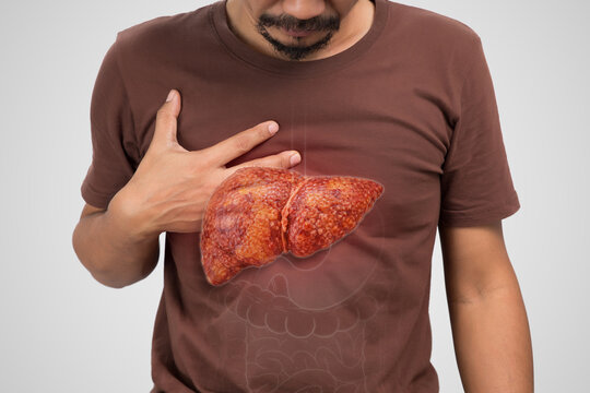 Male holding abdomen with highlighted liver illustrating cirrhosis hepatitis inflammation and related complications in healthcare concept