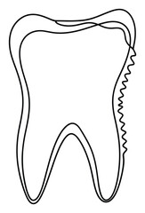 Obraz premium Outline of a human tooth depicting signs of enamel erosion or decay, perfect for dental clinic advertisements, educational content about oral care, and health awareness campaigns.