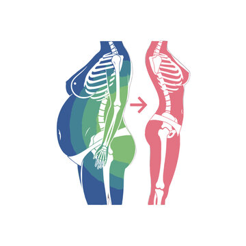 Body transformation showing skeletal structure before and after weight loss
