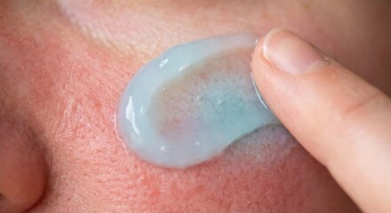 Fototapeta premium Macro of cooling blue gel applied to sun irritated skin