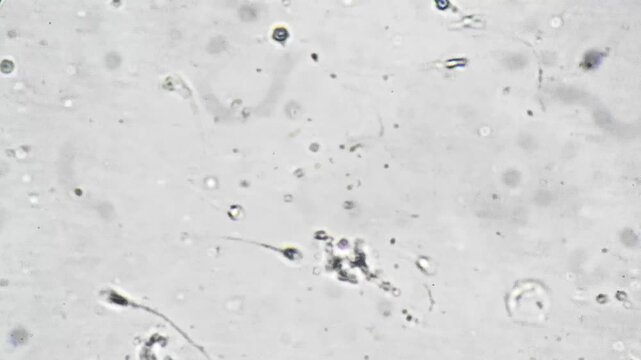 High magnification micrograph human sperm morphology revealing head shape and tail integrity, acrosome detail and stained granules, presence of nonmotile and irregular forms, scientist inspection