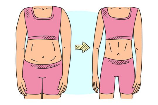 Fat and thin body doodle vector isolated. Hand-drawn illustration of a body shape. Female body in underwear. Idea of healthy lifestyle, diet and fitness exercise. Before and after.
