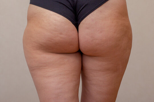 Back view of cropped lower body with cellulite on grey background