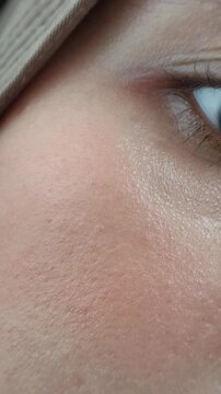Showing rosy cheeks after using blush on makeup.