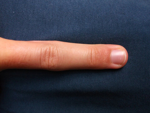 Un dedo de la mano encima posado en cima de tela