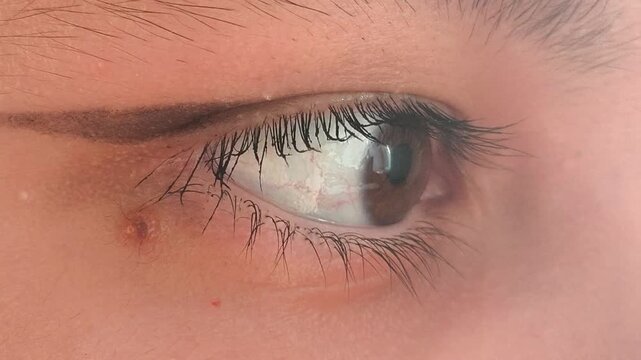 Close-up of a beautiful brown eye with an arrow. Eye makeup. vision problems, myopia, myopia, hyperopia. Ophthalmic diseases