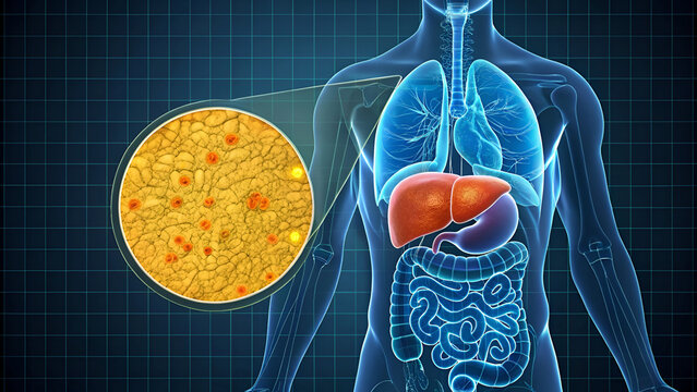 3D anatomy illustration of human liver anatomy with fatty liver disease