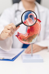 Doctor with Gastric anatomy model. Gastroenterologist consultation, stomach diseases and ulcers, November stomach cancer, Gastroesophageal Reflux Disease, GERD, Acid reflux and healthcare medical