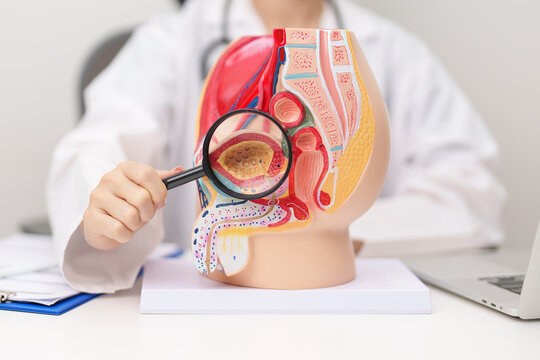 Doctor with Male Reproductive System anatomy model. Male consultation, Prostate Cancer, Enlarged prostate, Prostatitis disease, Male Infertility, Erectile dysfunction, Penis and Male genital disorder