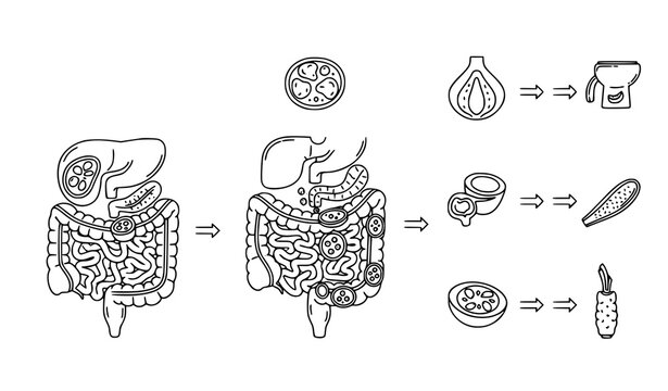A detailed vector graphic illustration showing the digestive system and the effects of different foods on gut health