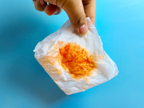 Red-stained tissue in hand, indicating respiratory symptoms like bloody sputum; crucial for early tuberculosis detection and effective treatment