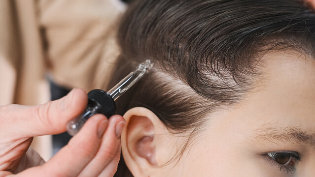 A trichologist applies an anti-hair loss treatment and scalp growth stimulant to a patient's scalp using a pipette from an ampoule in a beauty salon. Professional hair care