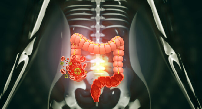 Detailed 3D anatomical model of the human colon and large intestine against a scientific background.