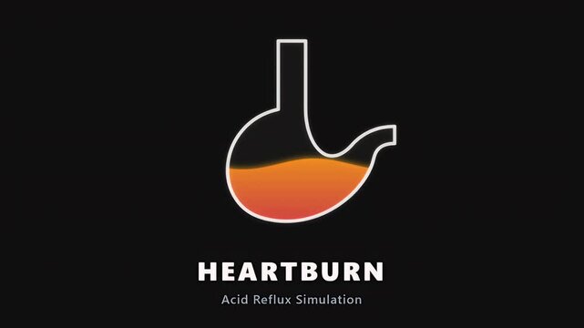 A conceptual medical illustration depicting human stomach acid reflux and heartburn symptoms for health education
