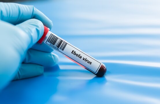 Blood sample tube for ebola virus test analysis.