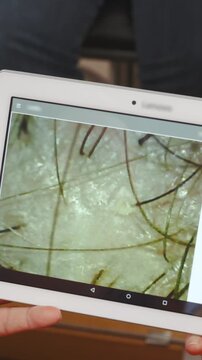 Taking screenshot of hair skin macro shot live view on tablet