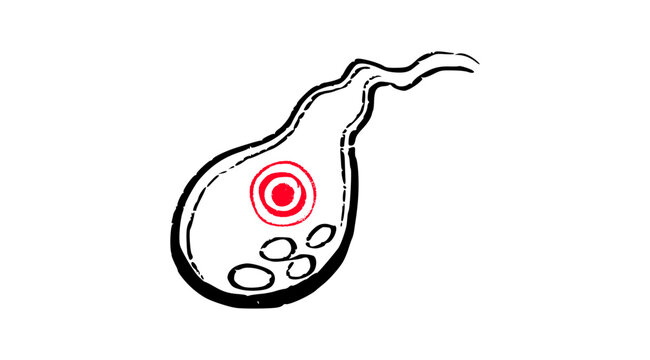 Human Gallbladder Disease