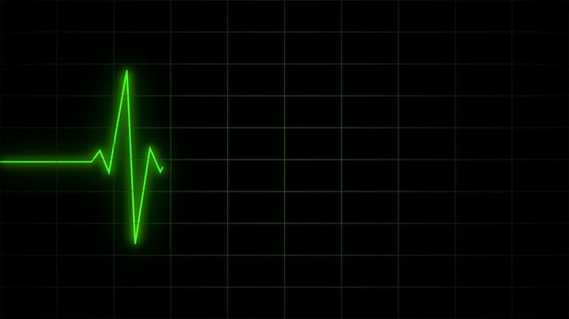 cardiograph recording heartbeat line frequency animation