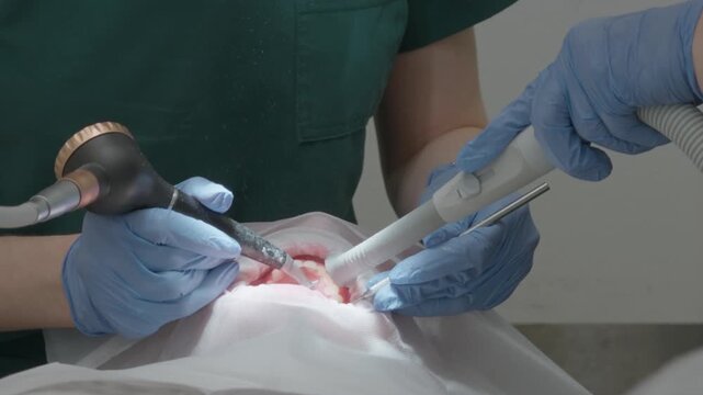Stomatologist using professional air flow sandblasting technology for deep teeth cleaning and plaque removal. Intensive oral hygiene prophylaxis treatment in modern dental clinic cabinet