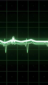 Vertical video: Glowing ECG traces running on grid, edge rising, peaking, subsiding, showing pulse