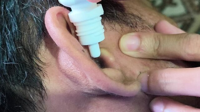 A close-up shot showing the process of administering medical ear drops from a white plastic dropper bottle into a person's ear to treat infection or remove wax