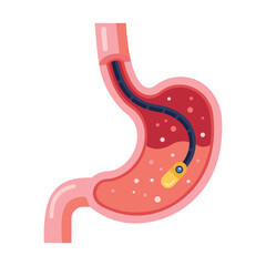 Stomach Endoscopy Medication Illustration Featuring Digestive Health Treatment and Gastric Relief Concept © Rahed Ul Islam