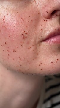 Macro close up of woman face with scrub on skin, exfoliation process, cleansing and removing dead skin cells, natural skincare treatment concept in vertical format