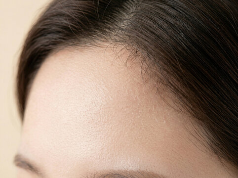 피부 비포 애프터 AI 피부개선 Skin Before After AI Skin Improvement