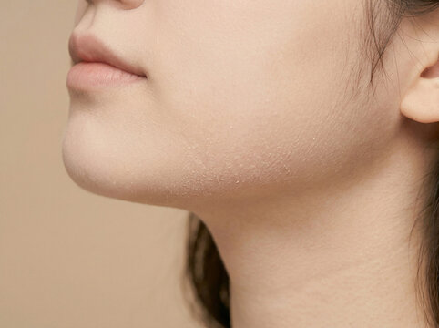 피부 비포 애프터 AI 피부개선 Skin Before After AI Skin Improvement