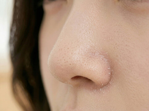 피부 비포 애프터 AI 피부개선 Skin Before After AI Skin Improvement