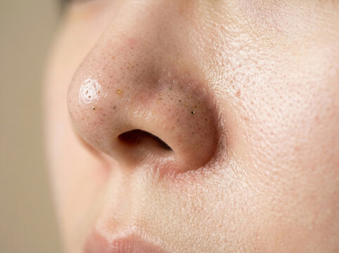 피부 비포 애프터 AI 피부개선 Skin Before After AI Skin Improvement