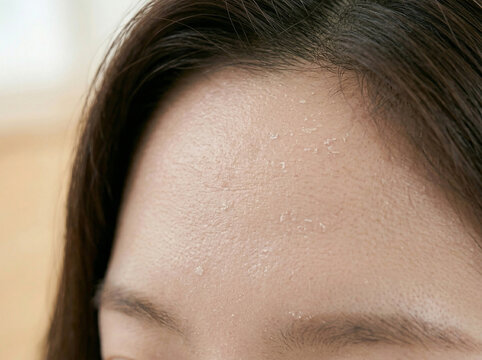 피부 비포 애프터 AI 피부개선 Skin Before After AI Skin Improvement