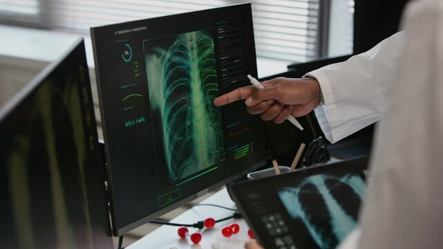 Cropped shot of hands of unrecognizable doctors analyzing chest x rays with artificial intelligence diagnostic support on digital devices in clinic
