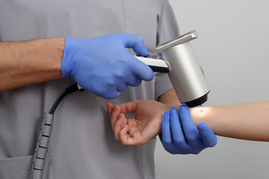 Dermatologist using digital dermatoscope to examine patient's mole on arm, doctor in blue gloves performing skin cancer screening and dermatology checkup in medical clinic