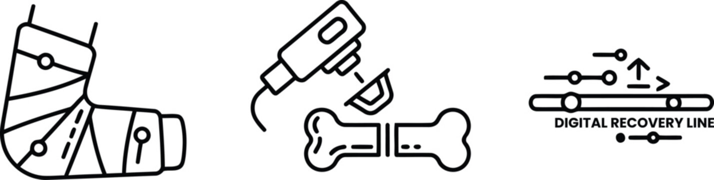 Vector of Orthopedic recovery icons set with leg cast bone fracture repair tool and digital recovery progress line