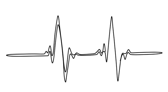 Abstract black line waveform with two prominent peaks and irregular oscillations