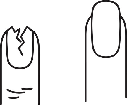 Broken fingernail versus healthy long nail comparison illustrating manicure problems and nail health care concept
