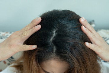 Naklejka premium Top view of Asian women's head with new black hair growth.