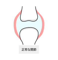 Obraz premium 痛風における正常な関節のイラスト