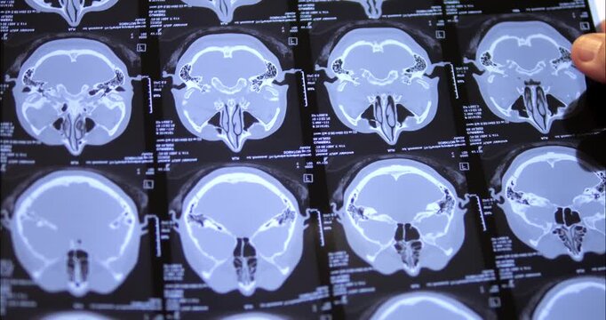 X-rays of the head, brain. X-rays of the back and spine. Doctor's examination and disease prevention.