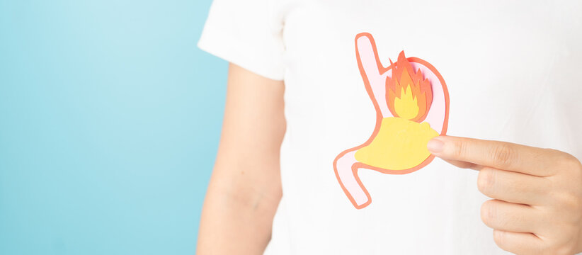 Woman suffering from stomach burn with acid reflux. Gastroesophageal reflux disease (GERD) or heartburn symptoms. Gastrointestinal system disease and digestive problems.