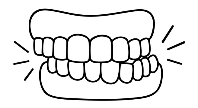 Bruxism teeth grinding and clenching condition, excessive pressure causing enamel wear and dental damage