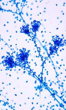 Blue-Stained Aspergillus Conidiophores Under Light Microscope &ndash; Fungal Spores and Hyphae