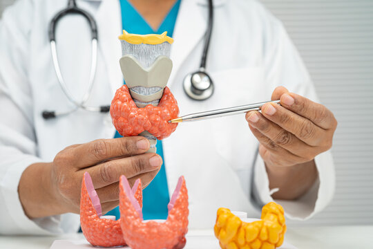 Hyperthyroidism, Overactive Thyroid, Thyroid Lymphoma, Asian doctor with thyroid gland human anatomy model in hospital.