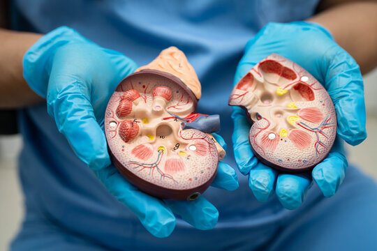 Chronic kidney disease, doctor with model for treatment urinary system, urology, Estimated glomerular filtration rate eGFR.