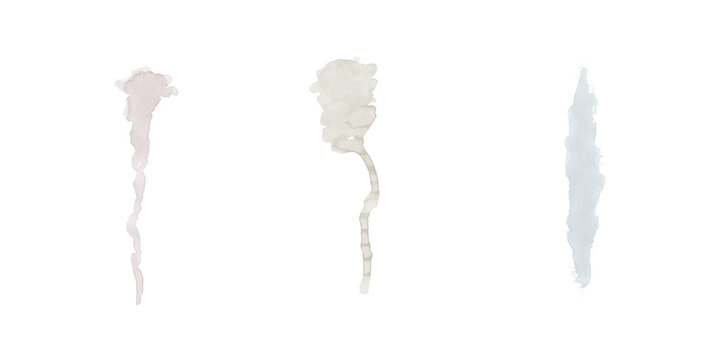 A microscopic view of three sperm cells against a black background