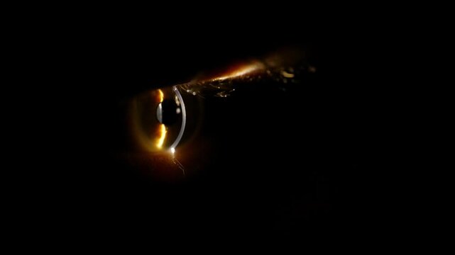 Macro photography of the eye, a close-up view of the eyeball during an examination of the eye using a slit lamp.