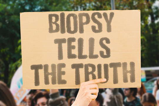 "Biopsy Tells The Truth" A tissue biopsy provides definitive pathological confirmation of whether a growth is malignant or benign. CANCER. BIOPSY. DIAGNOSE. TUMOR. CONFIRM.